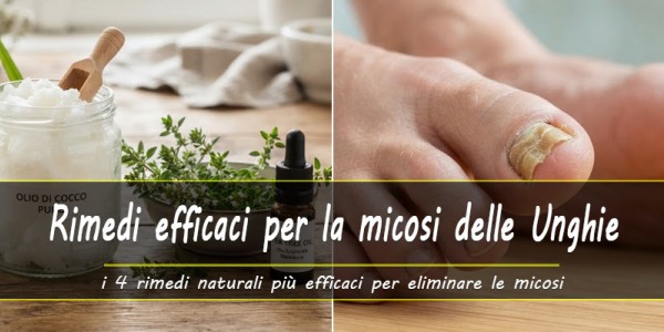 4 Rimedi naturali efficaci contro la micosi delle unghie
